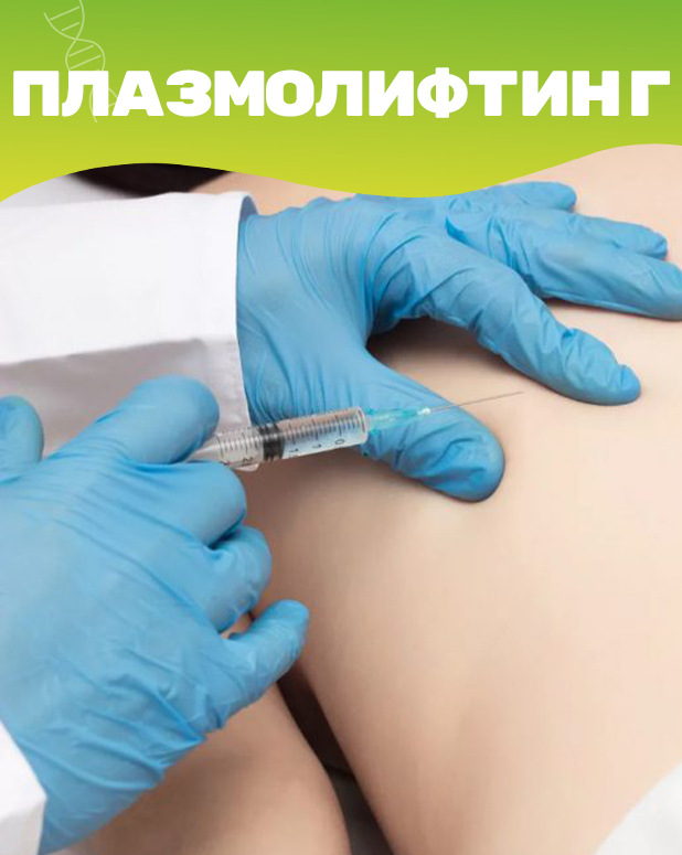 Плазмолифтинг